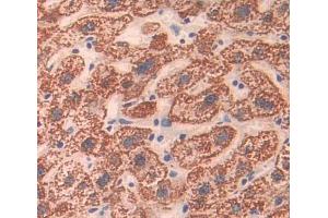 Immunohistochemistry (IHC) image for anti-ATP-Binding Cassette, Sub-Family A (ABC1), Member 8 (ABCA8) (AA 1263-1456) antibody (ABIN5013176)
