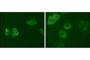Immunofluorescence analysis of Hela (Left) and MCF-7 (Right) cells using Tyro3 antibody (green). (TYRO3 抗体  (AA 138-321))