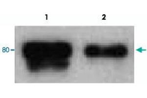 Western blotting after Immunoprecipitation with Dab1 polyclonal antibody . (DAB1 抗体)