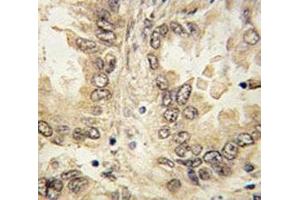 Immunohistochemistry (IHC) image for anti-SRY (Sex Determining Region Y)-Box 2 (SOX2) (AA 89-119) antibody (ABIN3032736)