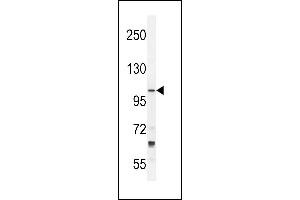 TLL2 Antibody (N-term) (ABIN392519 and ABIN2842079) western blot analysis in NCI- cell line lysates (35 μg/lane). (Tolloid-Like 2 抗体  (N-Term))