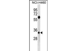 SDCBP Antibody (N-term) (ABIN1881779 and ABIN2838949) western blot analysis in NCI- cell line lysates (35 μg/lane). (SDCBP 抗体  (N-Term))