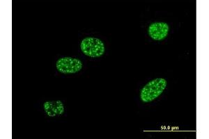 Immunofluorescence of monoclonal antibody to BNIP3L on HeLa cell.