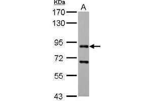 WB Image CD2AP antibody detects CD2AP protein by Western blot analysis. (CD2AP 抗体)