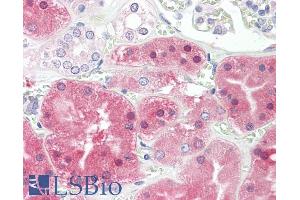 Immunohistochemistry (IHC) image for anti-Phenylalanine Hydroxylase (Internal Region) antibody (ABIN571236)