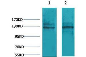 Western Blotting (WB) image for anti-Calcium-Sensing Receptor (CASR) antibody (ABIN3181546) (CASR 抗体)