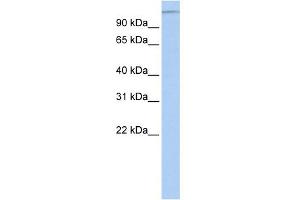 WB Suggested Anti-MTUS1 Antibody Titration:  0. (MTUS1 抗体  (Middle Region))