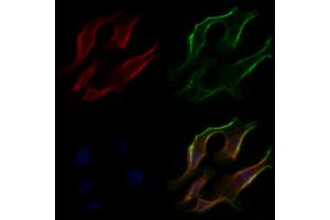 ABIN6266305 and ABIN6277424 staining Hela cells by IF/ICC.