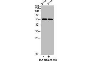 Western blot analysis of hela cells,hela cells, antibody was diluted at 500. (HNF4A 抗体  (acLys106))