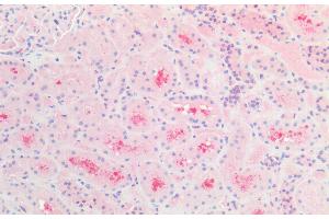 ABIN184784 (5 μg/mL) staining of paraffin embedded Human Kidney. (CBR1 抗体  (C-Term))