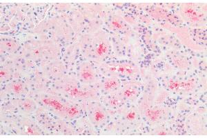 ABIN184784 (5 μg/mL) staining of paraffin embedded Human Kidney. (CBR1 抗体  (C-Term))