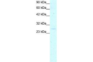 WB Suggested Anti-YEATS4 Antibody Titration:  0. (GAS41 抗体  (Middle Region))