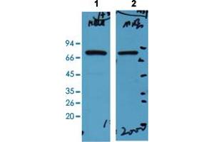 Western Blot analysis of Line 1: HeLa cell and Line 2: mouse brain tissue.