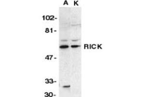 Image no. 1 for anti-Receptor-Interacting Serine-threonine Kinase 2 (RIPK2) (N-Term) antibody (ABIN201933) (RIPK2 抗体  (N-Term))