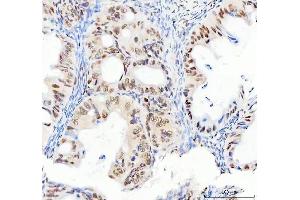 IHC analysis of DDX1 using anti-DDX1 antibody (ABIN7602050). (DDX1 抗体  (AA 562-740))