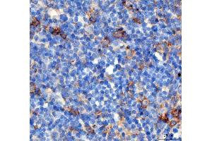 IHC analysis of PDCD1 using anti PDCD1 antibody (ABIN5518784). (PD-1 抗体  (N-Term))