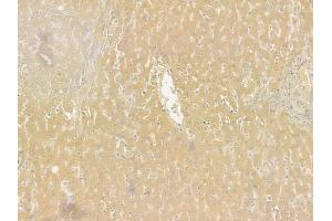 ABIN6261113 and ABIN6277549 at 1/100 staining human normal liver tissue by IHC-P. (Cullin 5 抗体  (Internal Region))