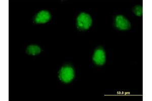Immunofluorescence of purified MaxPab antibody to RARB on HeLa cell. (Retinoic Acid Receptor beta 抗体  (AA 1-448))