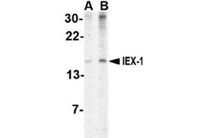 Western blot analysis of IEX1 in human brain tissue lysate with AP30400PU-N IEX1 antibody at (A) 2 and (B) 4 μg/ml. (IER3 抗体  (Center))