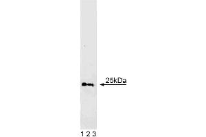 Western blot analysis of Rab5 on human endothelial cell lysate.