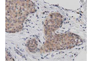 Image no. 4 for anti-DnaJ (Hsp40) Homolog, Subfamily A, Member 2 (DNAJA2) antibody (ABIN1497862)