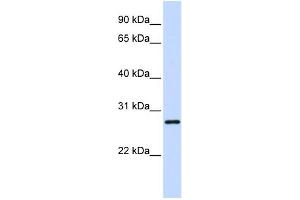 WB Suggested Anti-TGIF2LX Antibody Titration:  0. (TGIF2LX 抗体  (Middle Region))
