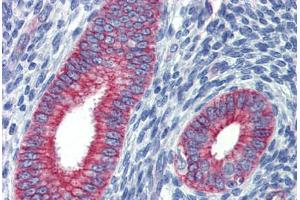 Immunohistochemistry (Formalin-fixed Paraffin-embedded Sections) (IHC (fp)) image for anti-Zinc Finger Protein 71 (ZNF71) (C-Term) antibody (ABIN6744444)