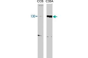 RBL2 monoclonal antibody, clone KAB40  recognizes both the phosphorylated and unphosphorylated forms of p130 at aMW of 130kDa. (p130 抗体  (N-Term))
