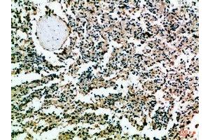 Immunohistochemical analysis of paraffin-embedded Human-spleen, antibody was diluted at 1:100 (CD52 抗体  (AA 20-50))