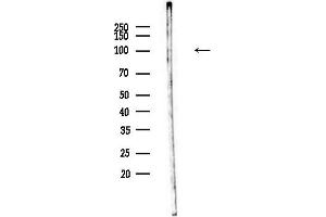 anti-SECIS Binding Protein 2 (SECISBP2) (Internal Region) antibody