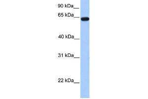 WB Suggested Anti-ZNF342 Antibody Titration:  0. (Zinc Finger Protein 296 (ZNF296) (N-Term) 抗体)
