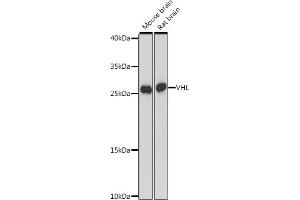Western Blotting (WB) image for anti-Von Hippel-Lindau Tumor Suppressor, E3 Ubiquitin Protein Ligase (VHL) (AA 1-100) antibody (ABIN7271338)
