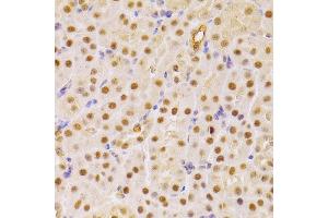 Immunohistochemistry of paraffin-embedded mouse kidney using CDC25A antibody (ABIN3021625, ABIN3021626, ABIN3021627 and ABIN6215426) at dilution of 1:100 (40x lens).