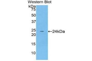 Western Blotting (WB) image for anti-Spectrin alpha Chain, Brain (SPTAN1) (AA 22-210) antibody (ABIN3208896) (SPTAN1 抗体  (AA 22-210))