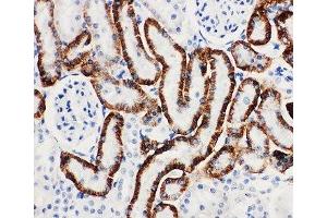 IHC-P: SLC22A6 antibody testing of rat kidney tissue (SLC22A6 抗体  (AA 534-550))