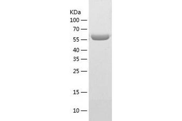 T-Bet Protein (AA 2-535) (His tag)