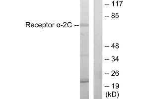 Western blot analysis of extracts from HepG2 cells, using Adrenergic Receptor alpha -2C antibody. (ADRA2C 抗体  (C-Term))