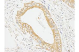 Immunohistochemistry (IHC) image for anti-Mitogen-Activated Protein Kinase Kinase Kinase Kinase 4 (MAP4K4) (AA 550-600) antibody (ABIN7448639)