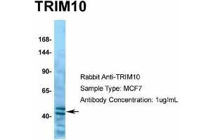 Human MCF7; Host: Rabbit. (TRIM10 抗体  (C-Term))