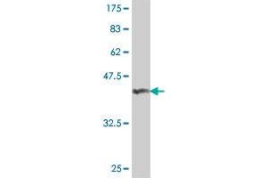 Western Blotting (WB) image for anti-ATP-Binding Cassette, Sub-Family B (MDR/TAP), Member 6 (ABCB6) (AA 743-842) antibody (ABIN564346)