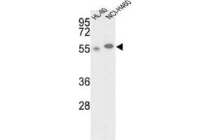 Western Blotting (WB) image for anti-Galactokinase 2 (GALK2) antibody (ABIN3002978) (GALK2 抗体)