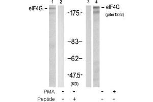 Image no. 2 for anti-Eukaryotic Translation Initiation Factor 4 Gamma, 1 (EIF4G1) (pSer1232) antibody (ABIN319277) (EIF4G1 抗体  (pSer1232))