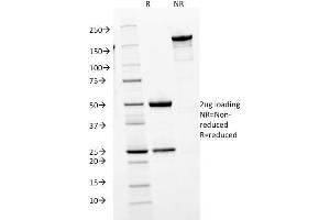 anti-Immunoglobulin Heavy Constant mu (IGHM) antibody