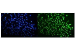IF analysis of SPAK/STK39 using anti-SPAK/STK39 antibody (ABIN7601373).
