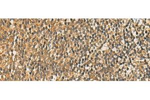 Immunohistochemistry of paraffin-embedded Human tonsil tissue using FAAP100 Polyclonal Antibody at dilution of 1:50(x200) (C17orf70 抗体)