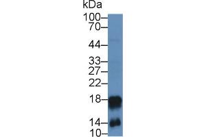 Western Blot; Sample: Mouse Spleen lysate; Primary Ab: 2µg/mL Rabbit Anti-Mouse CAMP Antibody Second Ab: 0. (Cathelicidin 抗体  (AA 31-172))