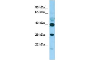 WB Suggested Anti-PISD Antibody Titration: 1. (PISD 抗体  (C-Term))