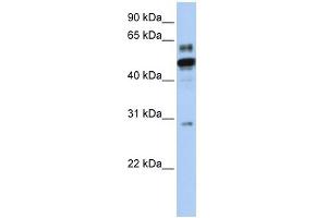 ESRRA antibody used at 1 ug/ml to detect target protein. (ESRRA 抗体  (N-Term))