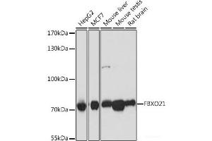 Western blot analysis of extracts of various cell lines using FBXO21 Polyclonal Antibody at dilution of 1:1000. (FBXO21 抗体)