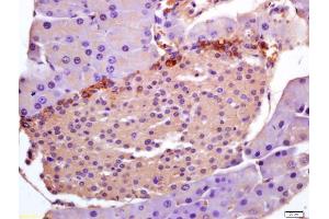 Immunohistochemistry (IHC) image for anti-Pleckstrin Homology-Like Domain, Family A, Member 1 (PHLDA1) (AA 251-360) antibody (ABIN685492)